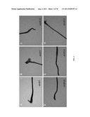 METHODS FOR P2RY5 MEDIATED REGULATION OF HAIR GROWTH AND MUTANTS THEREOF diagram and image