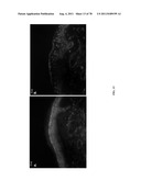 METHODS FOR P2RY5 MEDIATED REGULATION OF HAIR GROWTH AND MUTANTS THEREOF diagram and image