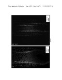 METHODS FOR P2RY5 MEDIATED REGULATION OF HAIR GROWTH AND MUTANTS THEREOF diagram and image