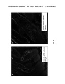 METHODS FOR P2RY5 MEDIATED REGULATION OF HAIR GROWTH AND MUTANTS THEREOF diagram and image