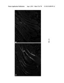 METHODS FOR P2RY5 MEDIATED REGULATION OF HAIR GROWTH AND MUTANTS THEREOF diagram and image