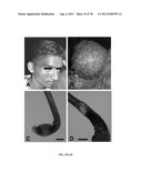 METHODS FOR P2RY5 MEDIATED REGULATION OF HAIR GROWTH AND MUTANTS THEREOF diagram and image