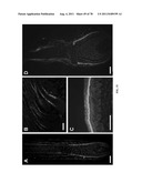 METHODS FOR P2RY5 MEDIATED REGULATION OF HAIR GROWTH AND MUTANTS THEREOF diagram and image