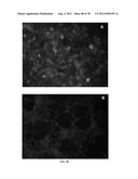 METHODS FOR P2RY5 MEDIATED REGULATION OF HAIR GROWTH AND MUTANTS THEREOF diagram and image