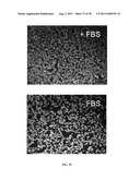 METHODS FOR P2RY5 MEDIATED REGULATION OF HAIR GROWTH AND MUTANTS THEREOF diagram and image