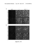 METHODS TO TREAT NEURODEGENERATIVE CONDITIONS OR DISEASES BY TARGETING     COMPONENTS OF A PTEN SIGNALING PATHWAY diagram and image