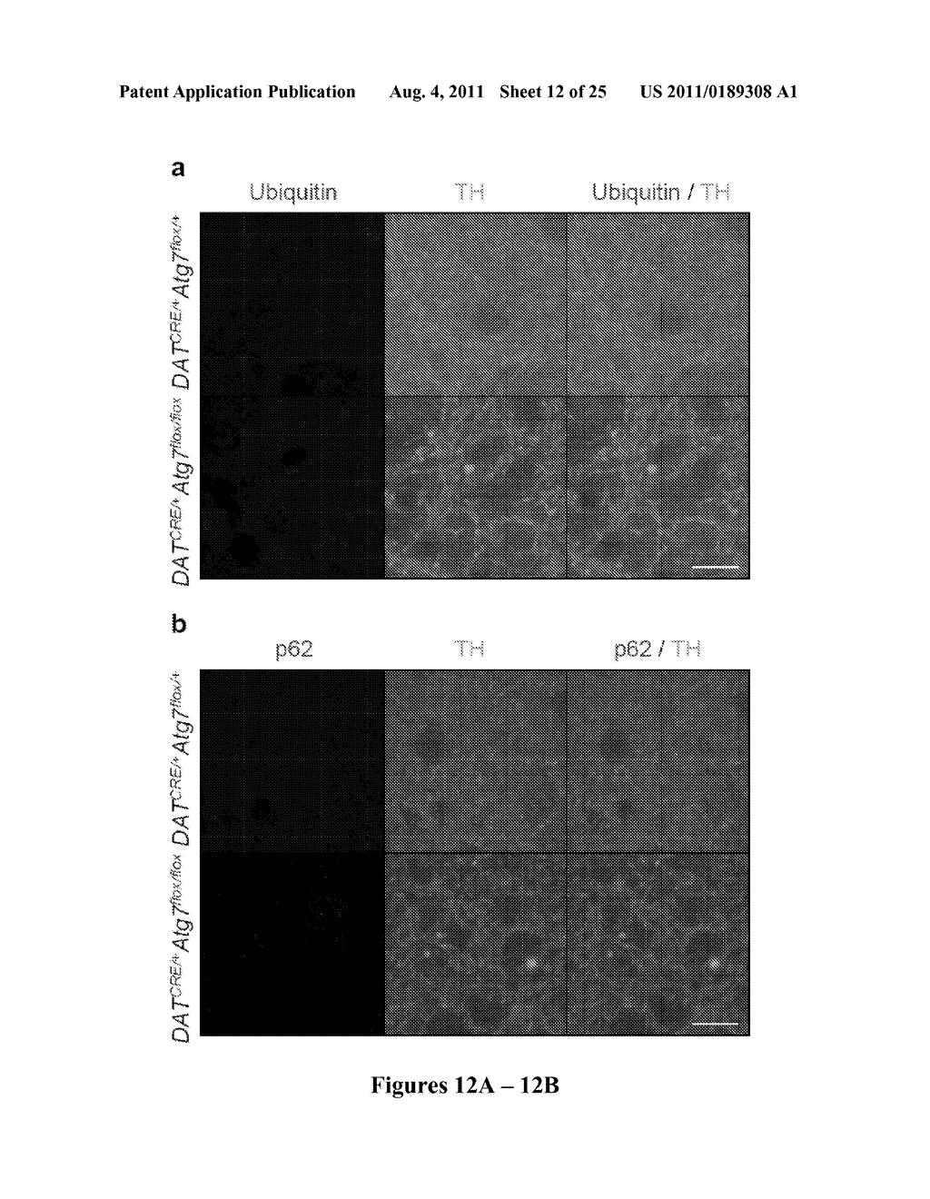 METHODS TO TREAT NEURODEGENERATIVE CONDITIONS OR DISEASES BY TARGETING     COMPONENTS OF A PTEN SIGNALING PATHWAY - diagram, schematic, and image 13