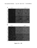 METHODS TO TREAT NEURODEGENERATIVE CONDITIONS OR DISEASES BY TARGETING     COMPONENTS OF A PTEN SIGNALING PATHWAY diagram and image