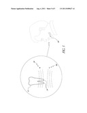 ROOT CANAL FILLING MATERIALS AND METHODS diagram and image