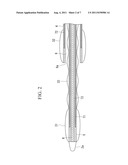 Surgical method and medical device diagram and image