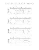 Surgical method and medical device diagram and image