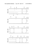 Surgical method and medical device diagram and image