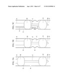 Surgical method and medical device diagram and image