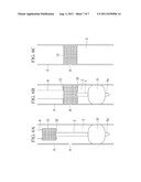 Surgical method and medical device diagram and image