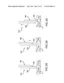 Sensor Inserter Having Introducer diagram and image