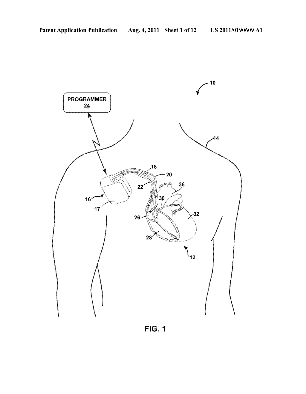 OPTICAL SENSOR FOR MEDICAL DEVICE - diagram, schematic, and image 02