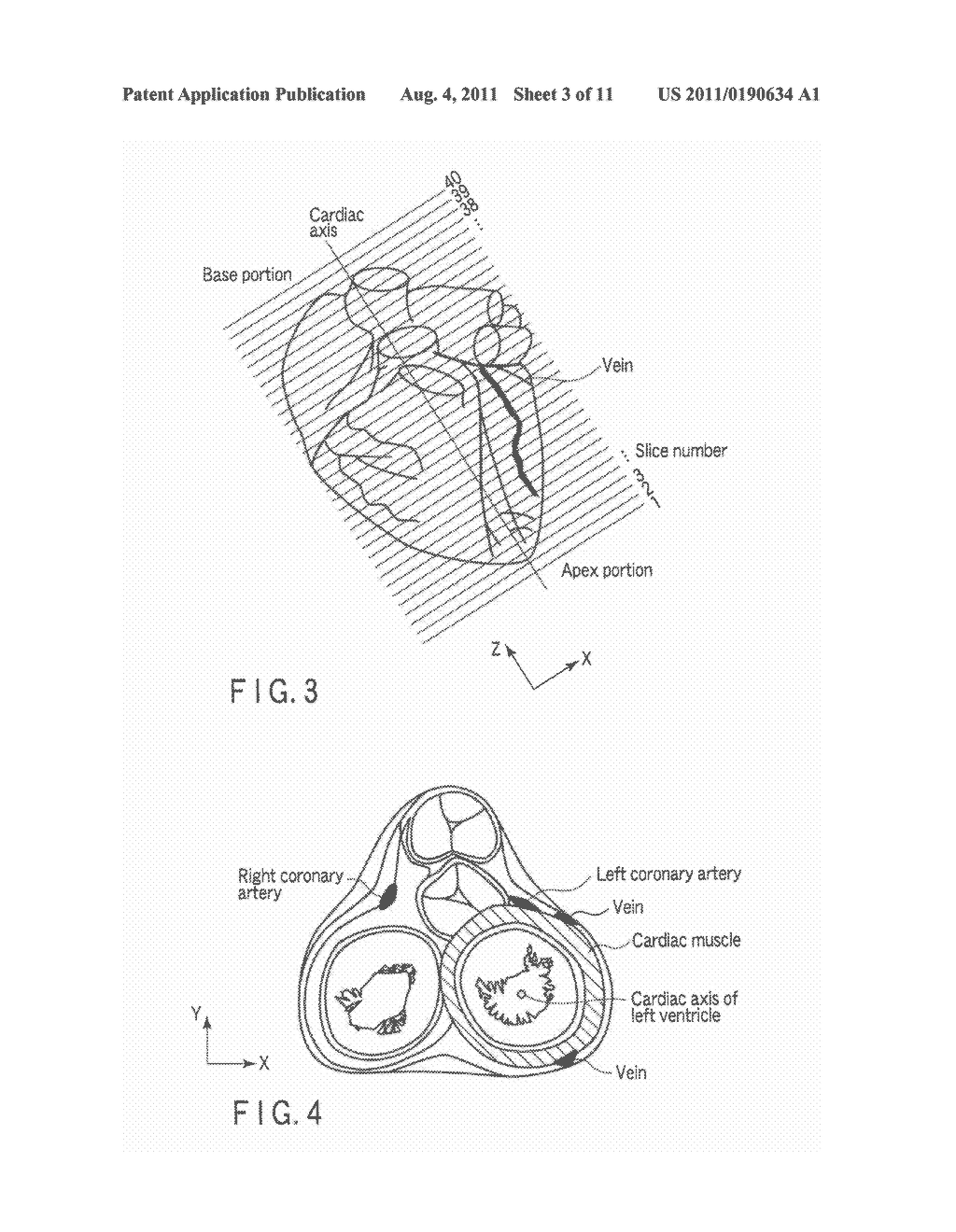 ULTRASONIC DIAGNOSTIC APPARATUS AND MEDICAL IMAGE PROCESSING APPARATUS - diagram, schematic, and image 04