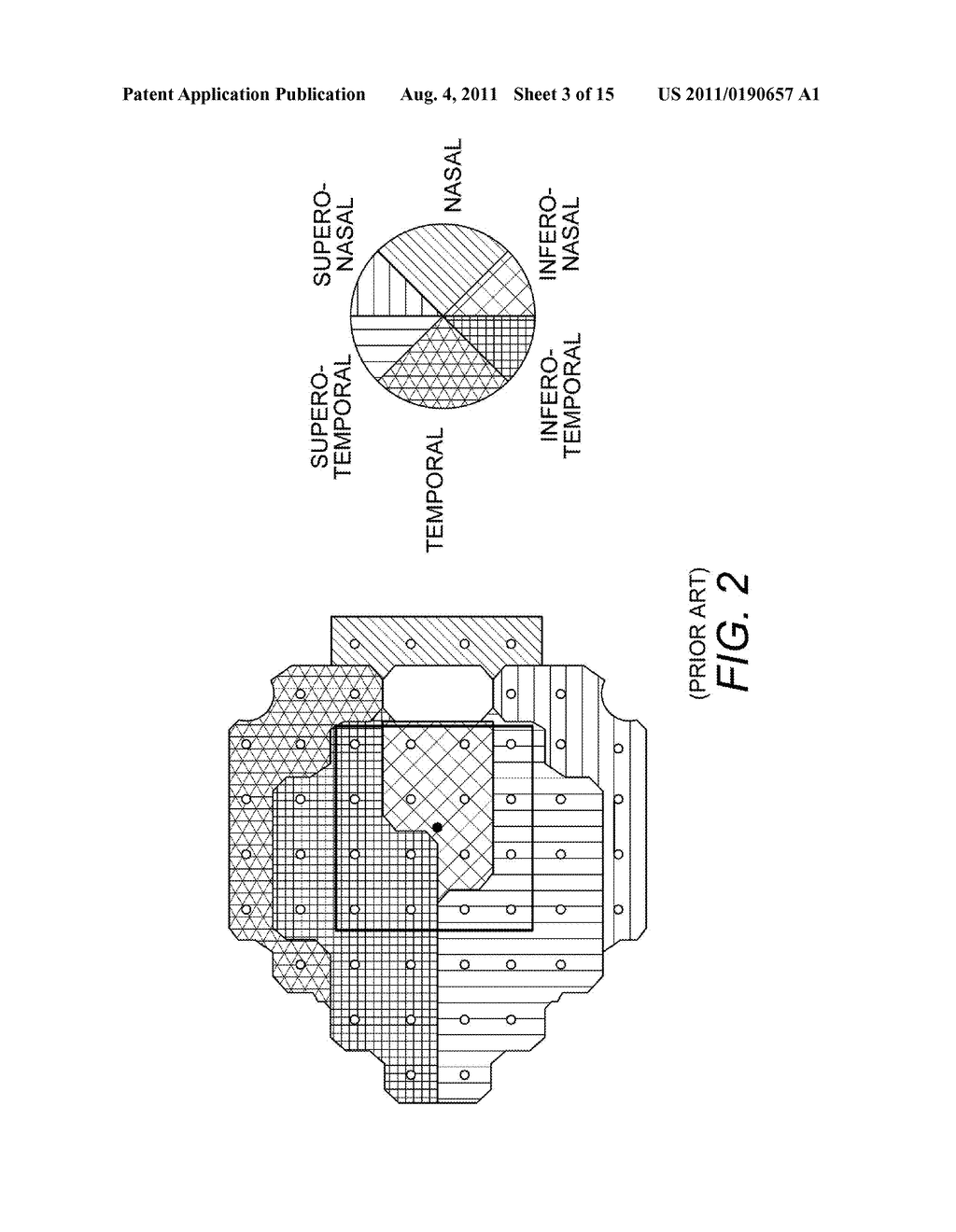 GLAUCOMA COMBINATORIAL ANALYSIS - diagram, schematic, and image 04