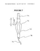 RAPID EXCHANGE FNA BIOPSY DEVICE WITH DIAGNOSTIC AND THERAPEUTIC     CAPABILITIES diagram and image