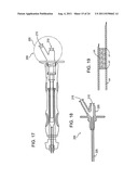 RAPID EXCHANGE FNA BIOPSY DEVICE WITH DIAGNOSTIC AND THERAPEUTIC     CAPABILITIES diagram and image