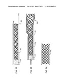 RAPID EXCHANGE FNA BIOPSY DEVICE WITH DIAGNOSTIC AND THERAPEUTIC     CAPABILITIES diagram and image