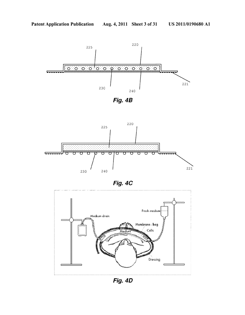 Self-Regulating Device for Modulating Inflammation - diagram, schematic, and image 04