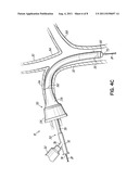 VASCULAR INTRODUCERS HAVING AN EXPANDABLE SECTION diagram and image