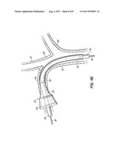 VASCULAR INTRODUCERS HAVING AN EXPANDABLE SECTION diagram and image