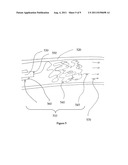 Method and Apparatus for Delivering an Agent to a Kidney diagram and image