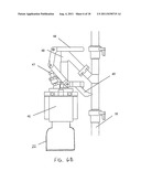 Systems And Methods For Removing Ingested Material From A Stomach diagram and image