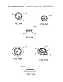 Systems And Methods For Removing Ingested Material From A Stomach diagram and image