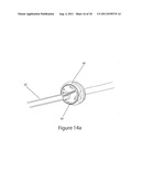 Systems And Methods For Removing Ingested Material From A Stomach diagram and image