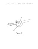 Systems And Methods For Removing Ingested Material From A Stomach diagram and image