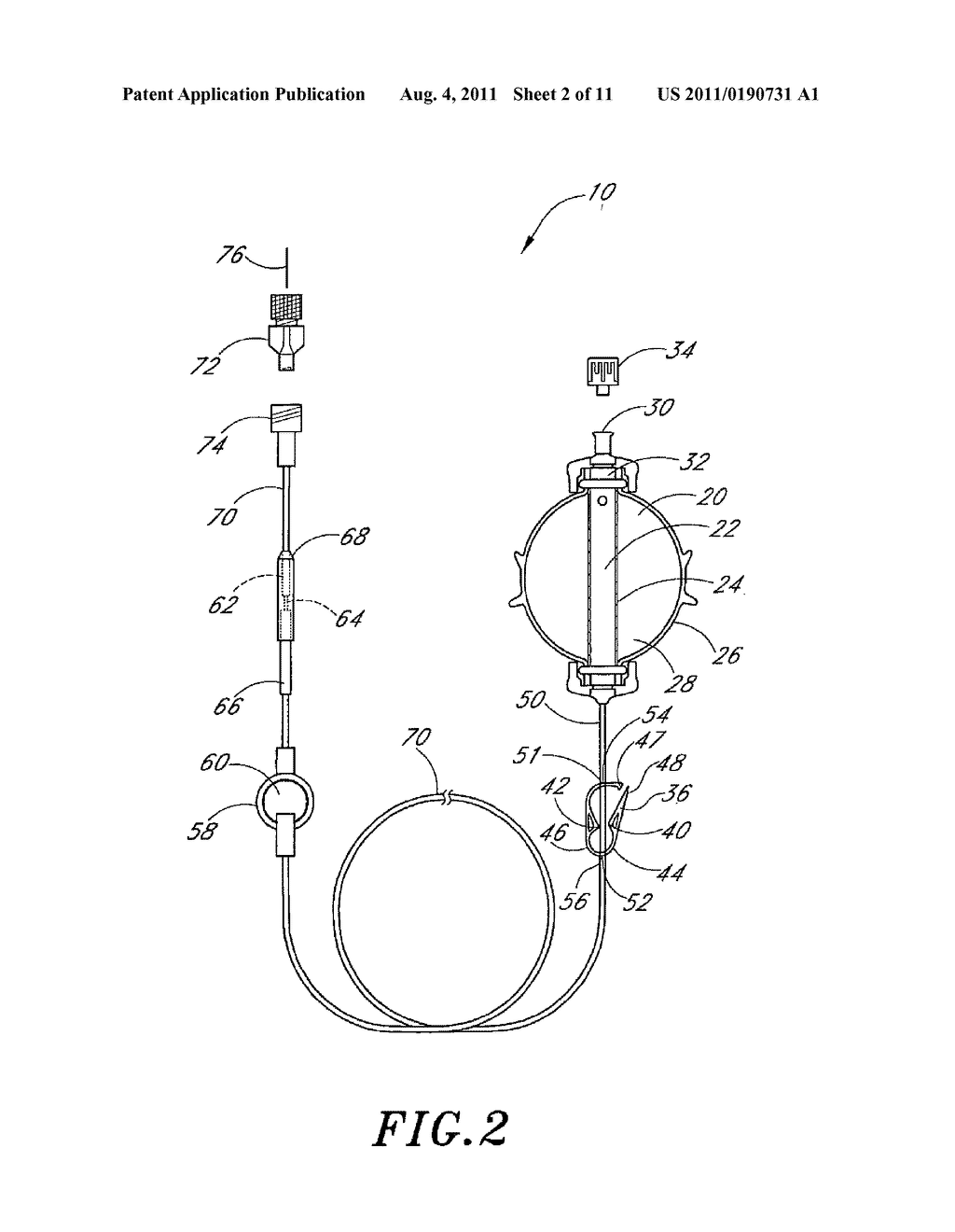 Method for Fluid Delivery and Catheters for Use with Same - diagram, schematic, and image 03