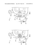 Wound Treatment Apparatuses and Methods for Controlled Delivery of Fluids     to a Wound diagram and image