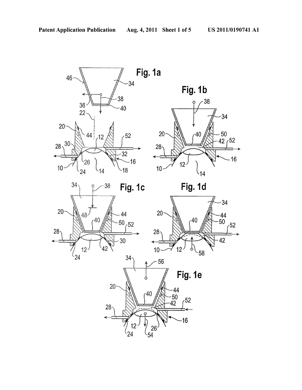 Coupling of an eye to a laser device - diagram, schematic, and image 02