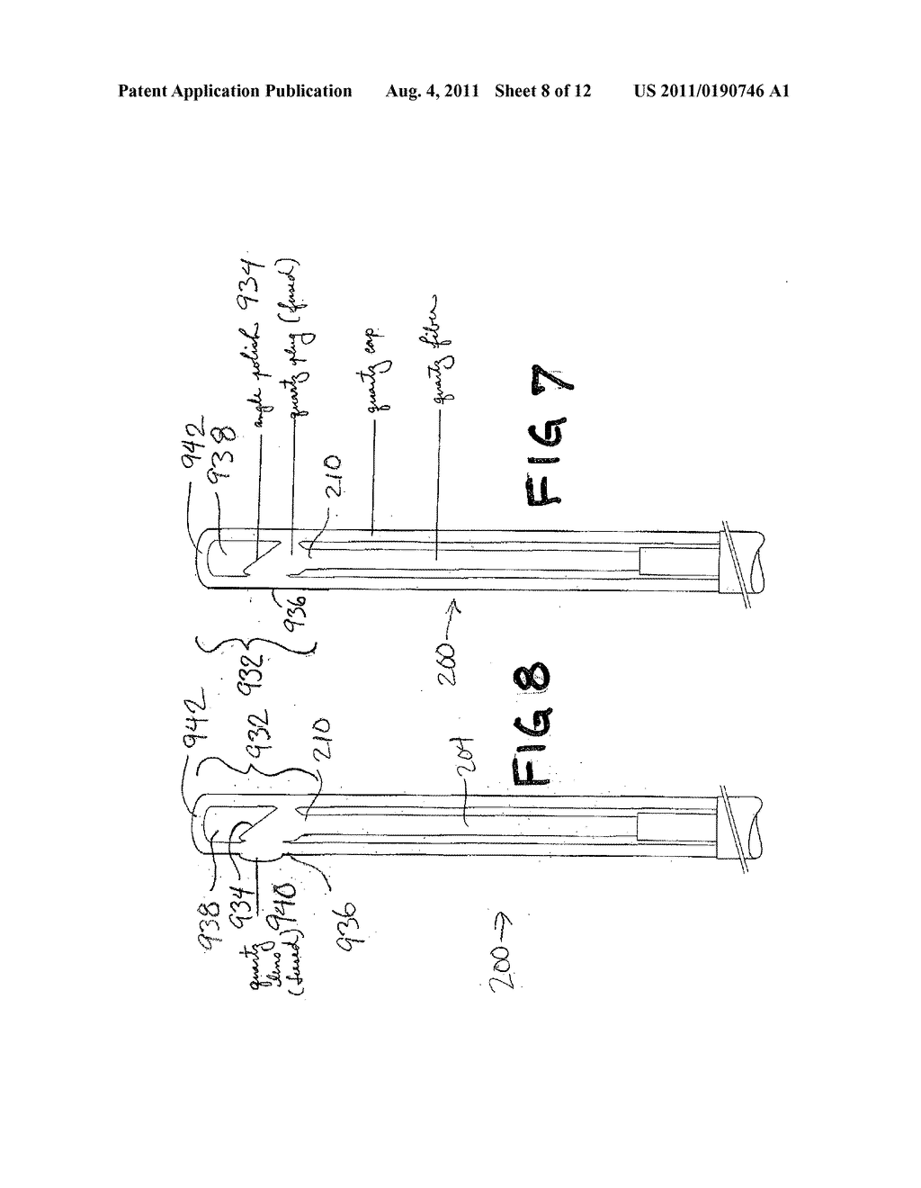 CONTACT LASER ABLATION OF TISSUE - diagram, schematic, and image 09