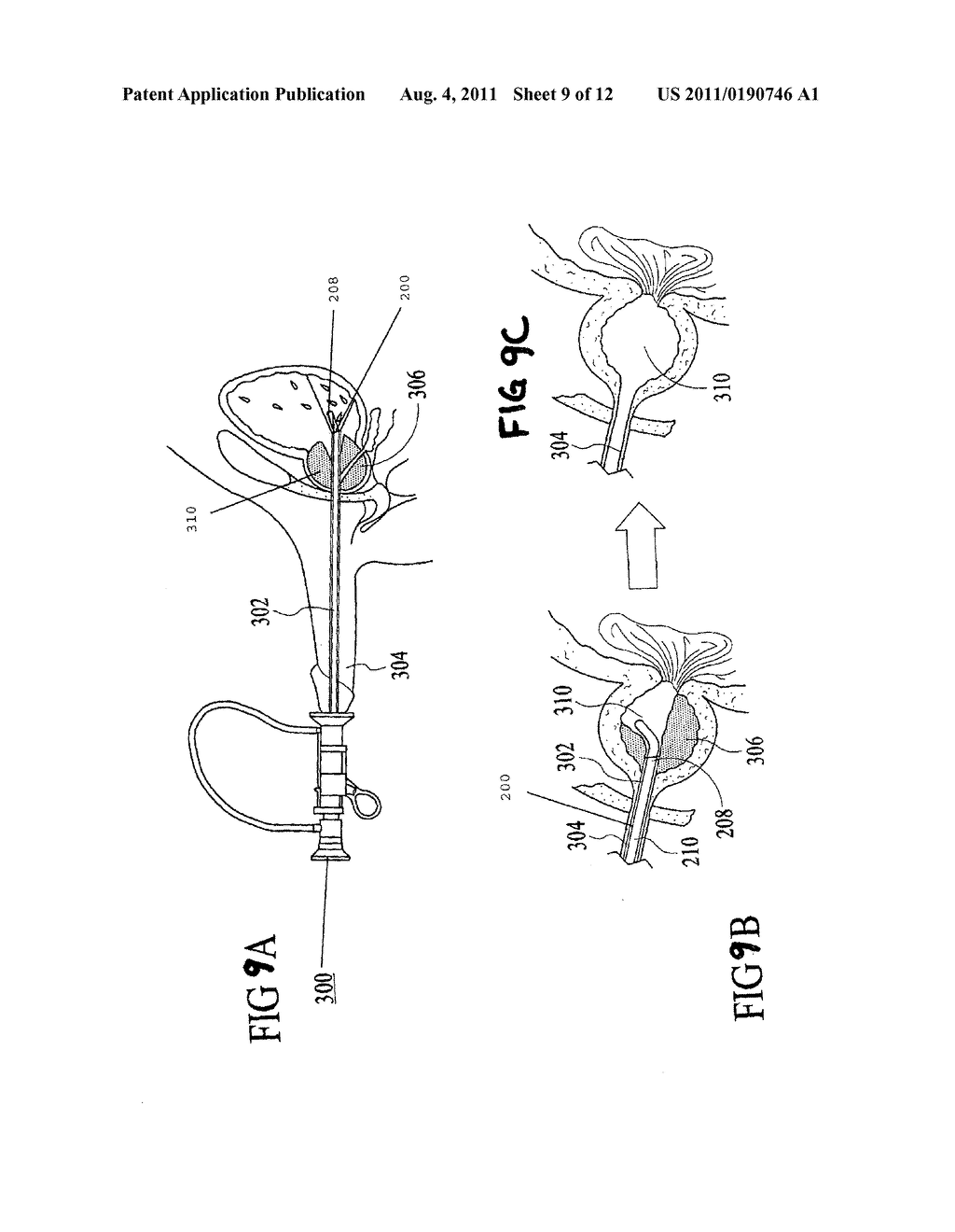 CONTACT LASER ABLATION OF TISSUE - diagram, schematic, and image 10