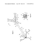 Multiple Port Introducer for Thrombolysis diagram and image