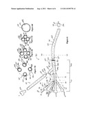 Multiple Port Introducer for Thrombolysis diagram and image