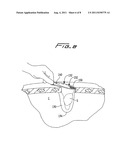 SURGICAL RETRIEVAL APPARATUS diagram and image