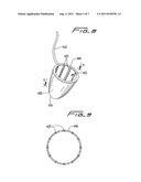 SURGICAL RETRIEVAL APPARATUS diagram and image