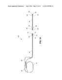 INTRODUCTION OF MEDICAL LEAD INTO PATIENT diagram and image