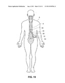 INTRODUCTION OF MEDICAL LEAD INTO PATIENT diagram and image