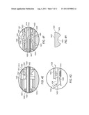 TISSUE REMOVAL DEVICE WITH TISSUE GRIP diagram and image