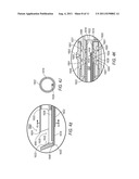 TISSUE REMOVAL DEVICE WITH TISSUE GRIP diagram and image