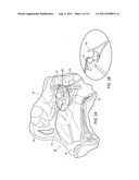 SYSTEM AND METHOD FOR SURGERY diagram and image