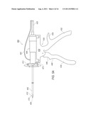 SYSTEM AND METHOD FOR SURGERY diagram and image