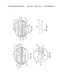 SYSTEM AND METHOD FOR SURGERY diagram and image