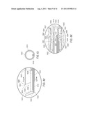 SYSTEM AND METHOD FOR SURGERY diagram and image